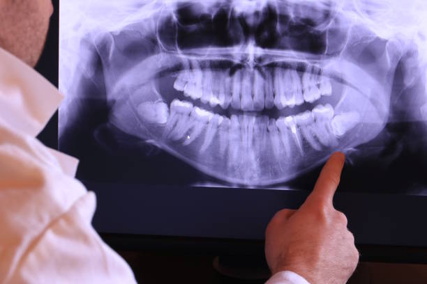 Best Emergency Denture Repair in Hummelstown, PA