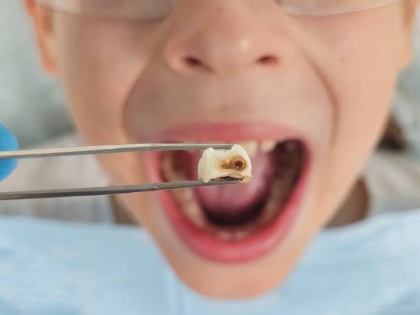Best Emergency Treatment for Jaw Pain or Injury in Hummelstown, PA